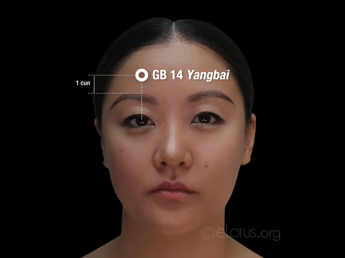 Yangbai (GB 14) | Master Tung’s Acupuncture | eLotus CORE